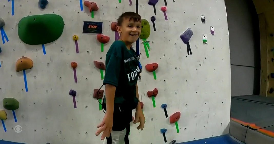 Children with hand and arm differences learning to rock climb at special camp